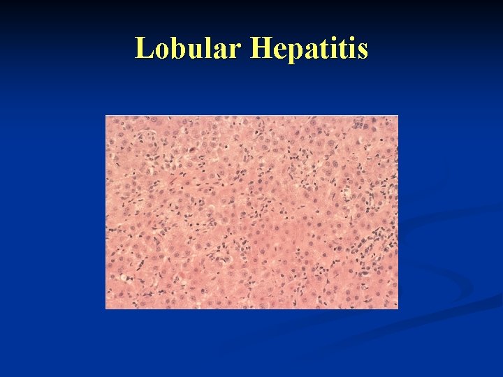 Lobular Hepatitis 