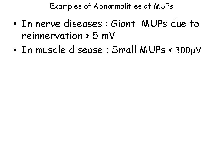 Examples of Abnormalities of MUPs • In nerve diseases : Giant MUPs due to