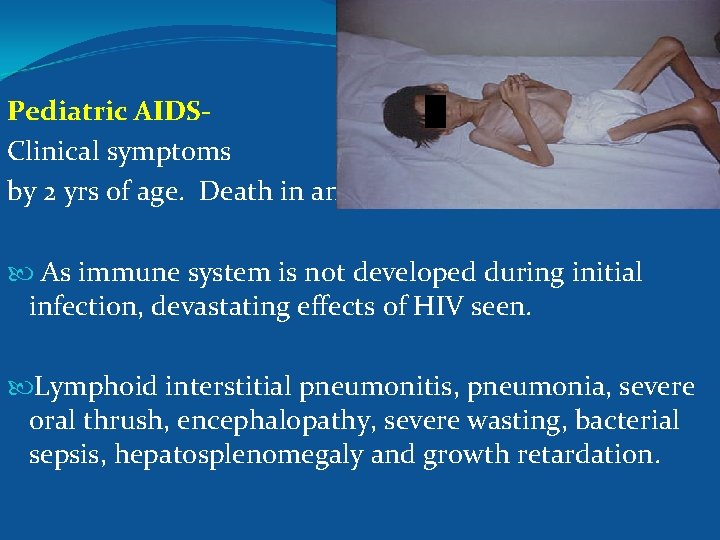 Pediatric AIDSClinical symptoms by 2 yrs of age. Death in another 2 yrs. As