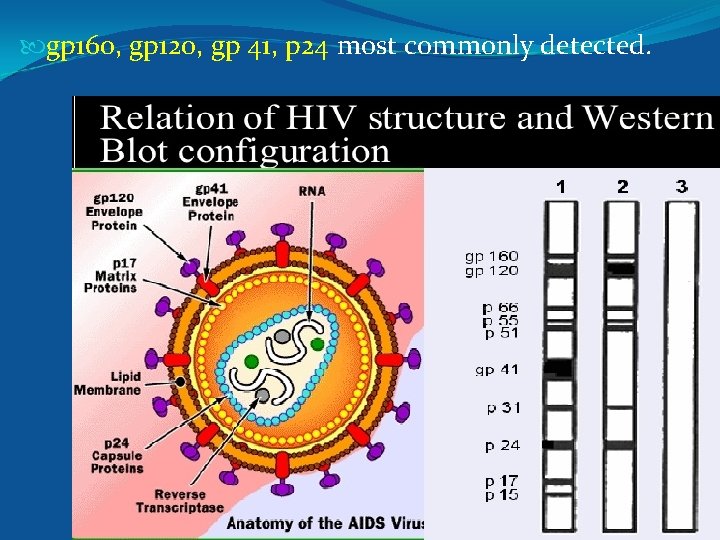  gp 160, gp 120, gp 41, p 24 most commonly detected. 
