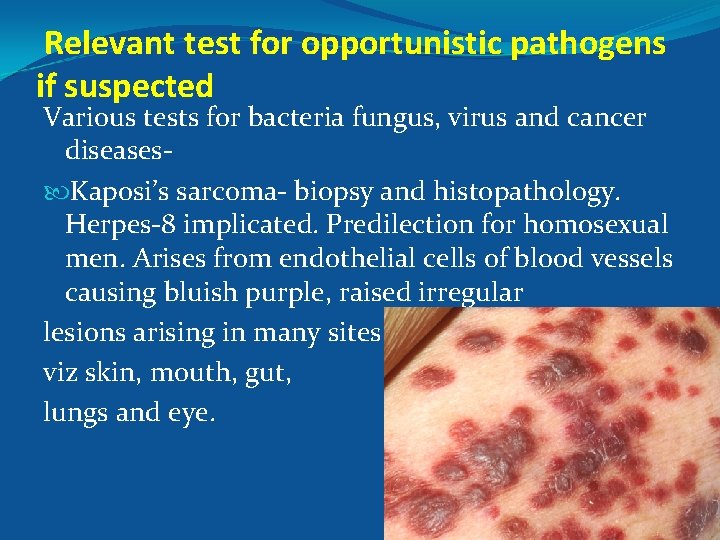 Relevant test for opportunistic pathogens if suspected Various tests for bacteria fungus, virus and