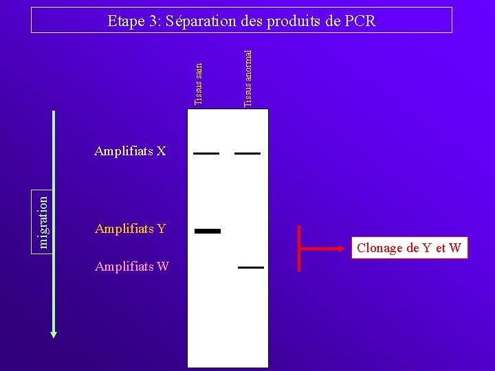 Tissus anormal Tissus sain Etape 3: Séparation des produits de PCR migration Amplifiats X