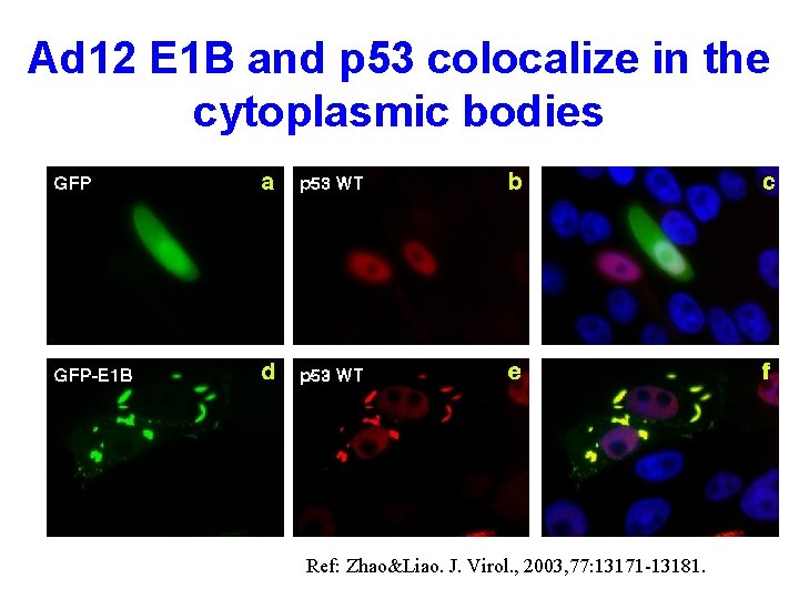 Ad 12 E 1 B and p 53 colocalize in the cytoplasmic bodies Ref: