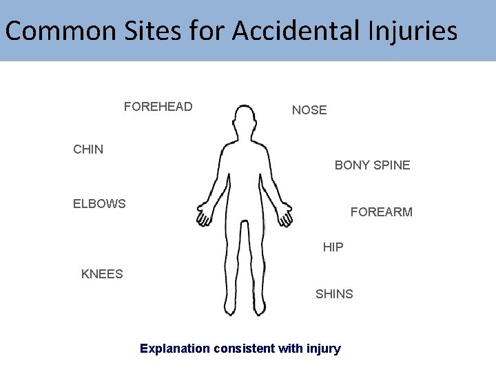 Common Sites for Accidental Injuries FOREHEAD NOSE CHIN BONY SPINE ELBOWS FOREARM HIP KNEES