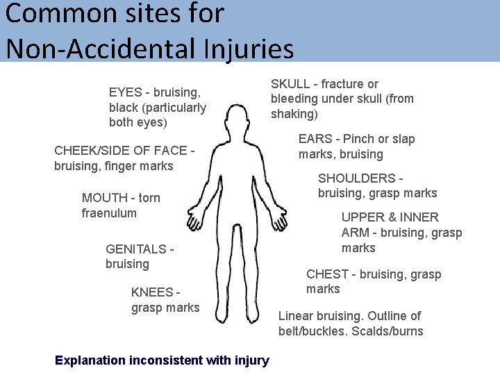 Common sites for Non-Accidental Injuries EYES - bruising, black (particularly both eyes) CHEEK/SIDE OF