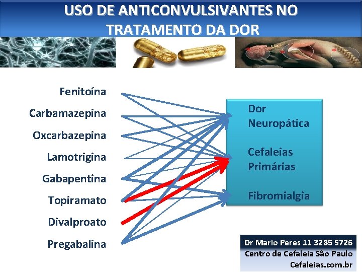 USO DE ANTICONVULSIVANTES NO TRATAMENTO DA DOR Fenitoína Carbamazepina Oxcarbazepina Lamotrigina Gabapentina Topiramato Dor