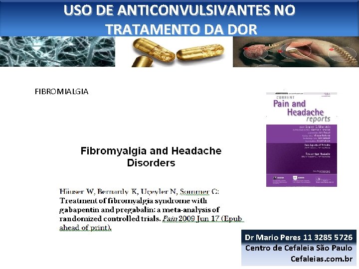 USO DE ANTICONVULSIVANTES NO TRATAMENTO DA DOR FIBROMIALGIA Dr Mario Peres 11 3285 5726