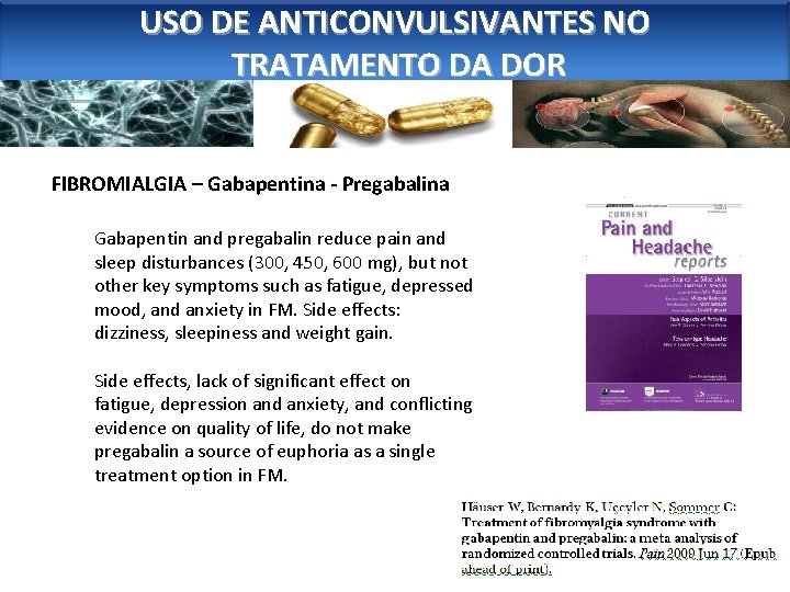 USO DE ANTICONVULSIVANTES NO TRATAMENTO DA DOR FIBROMIALGIA – Gabapentina - Pregabalina Gabapentin and