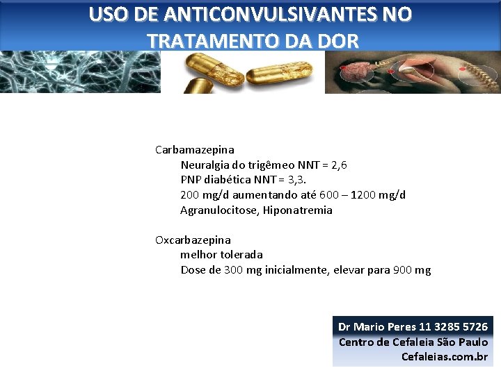 USO DE ANTICONVULSIVANTES NO TRATAMENTO DA DOR Carbamazepina Neuralgia do trigêmeo NNT = 2,