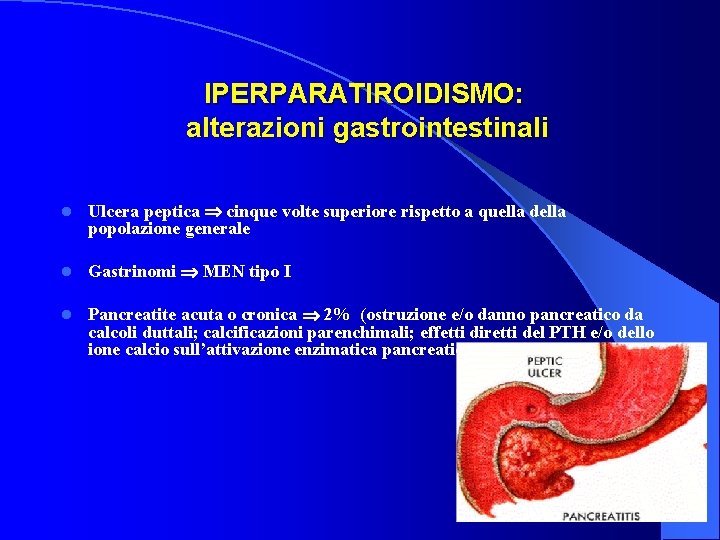  IPERPARATIROIDISMO: alterazioni gastrointestinali l Ulcera peptica cinque volte superiore rispetto a quella della