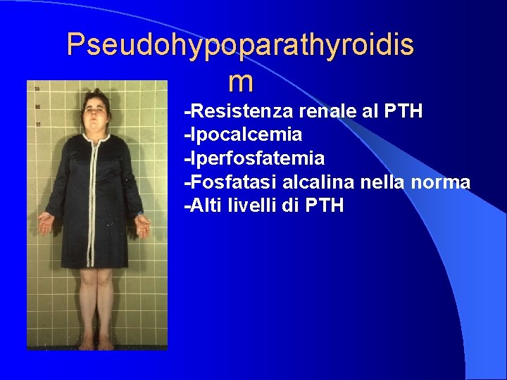 Pseudohypoparathyroidis m -Resistenza renale al PTH -Ipocalcemia -Iperfosfatemia -Fosfatasi alcalina nella norma -Alti livelli