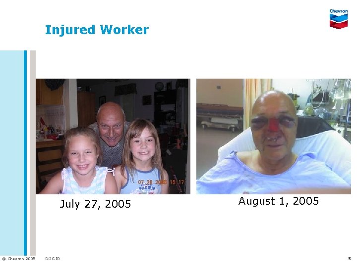 Injured Worker July 27, 2005 © Chevron 2005 DOC ID August 1, 2005 5