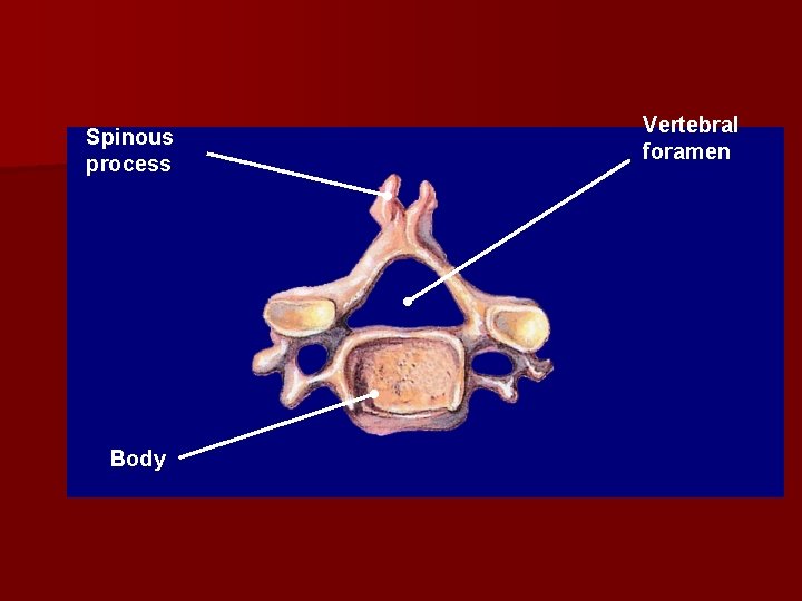 Spinous process Body Vertebral foramen Spinous process Body Vertebral foramen