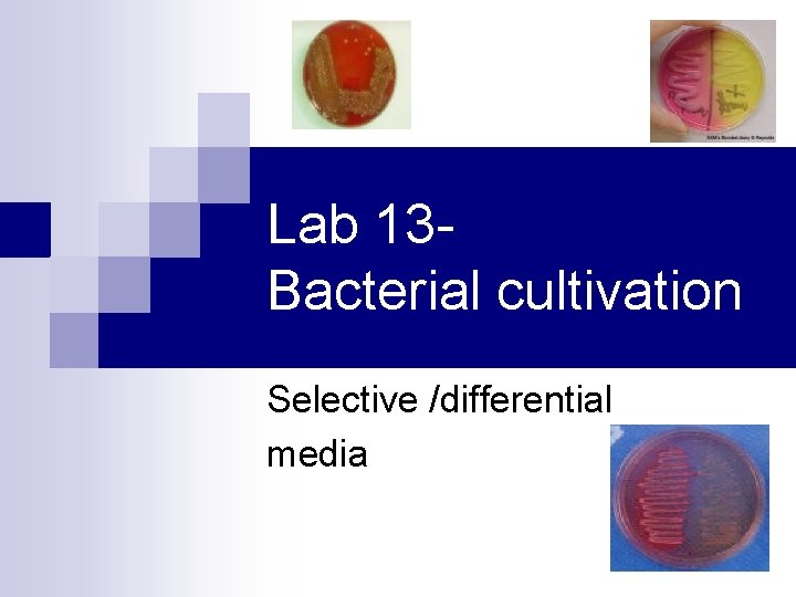 Lab 13 Bacterial cultivation Selective /differential media 