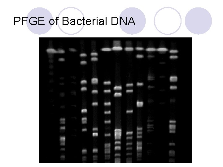 PFGE of Bacterial DNA 