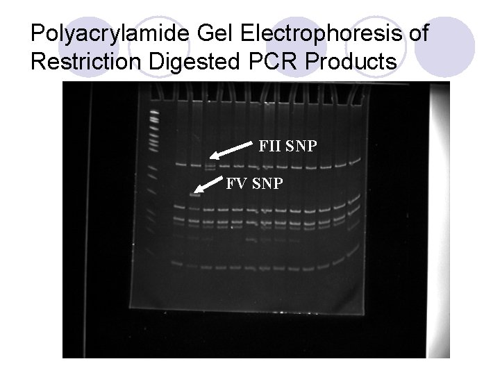 Polyacrylamide Gel Electrophoresis of Restriction Digested PCR Products FII SNP FV SNP 