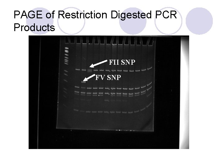 PAGE of Restriction Digested PCR Products FII SNP FV SNP 