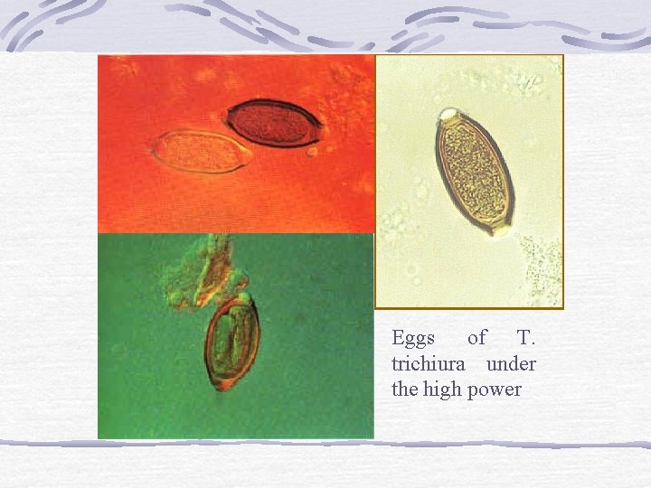 Eggs of T. trichiura under the high power 