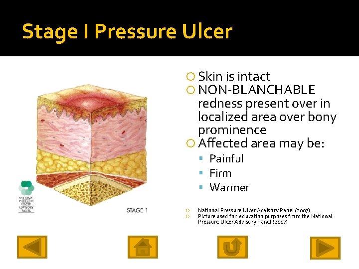 Stage I Pressure Ulcer Skin is intact NON-BLANCHABLE redness present over in localized area