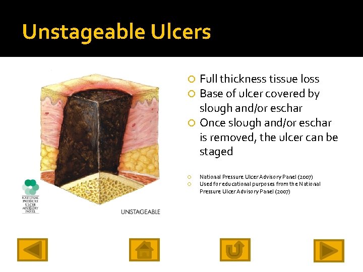 Unstageable Ulcers Full thickness tissue loss Base of ulcer covered by slough and/or eschar