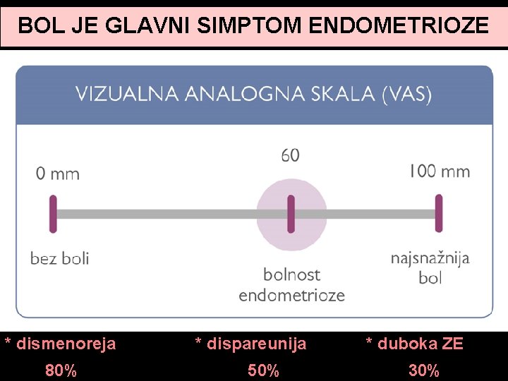 BOL JE GLAVNI SIMPTOM ENDOMETRIOZE * dismenoreja 80% * dispareunija 50% * duboka ZE BOL JE GLAVNI SIMPTOM ENDOMETRIOZE * dismenoreja 80% * dispareunija 50% * duboka ZE