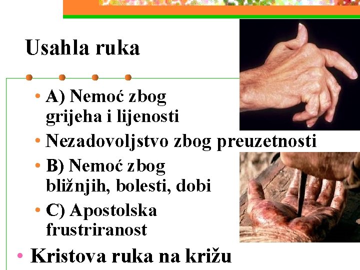 Usahla ruka • A) Nemoć zbog grijeha i lijenosti • Nezadovoljstvo zbog preuzetnosti • Usahla ruka • A) Nemoć zbog grijeha i lijenosti • Nezadovoljstvo zbog preuzetnosti •