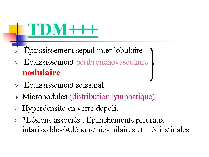 TDM+++ Ø Ø Épaississement septal inter lobulaire Épaississement péribronchovasculaire nodulaire Ø Ø Épaississement scissural