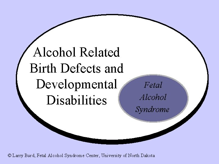 Alcohol Related Birth Defects and Developmental Disabilities Fetal Alcohol Syndrome © Larry Burd, Fetal