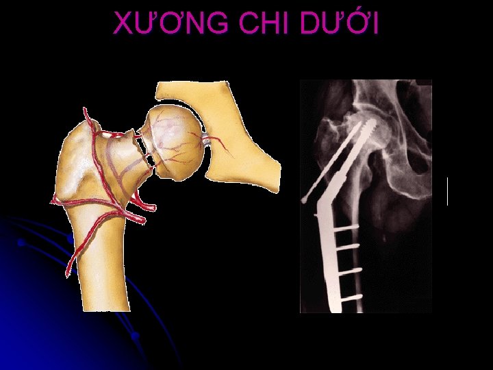 XƯƠNG CHI DƯỚI 