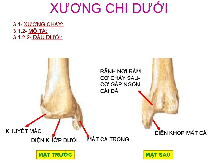 XƯƠNG CHI DƯỚI 3. 1 - XƯƠNG CHÀY: 3. 1. 2 - MÔ TẢ: