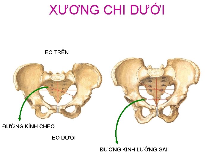 XƯƠNG CHI DƯỚI EO TRÊN ĐƯỜNG KÍNH CHÉO EO DƯỚI ĐƯỜNG KÍNH LƯỠNG GAI