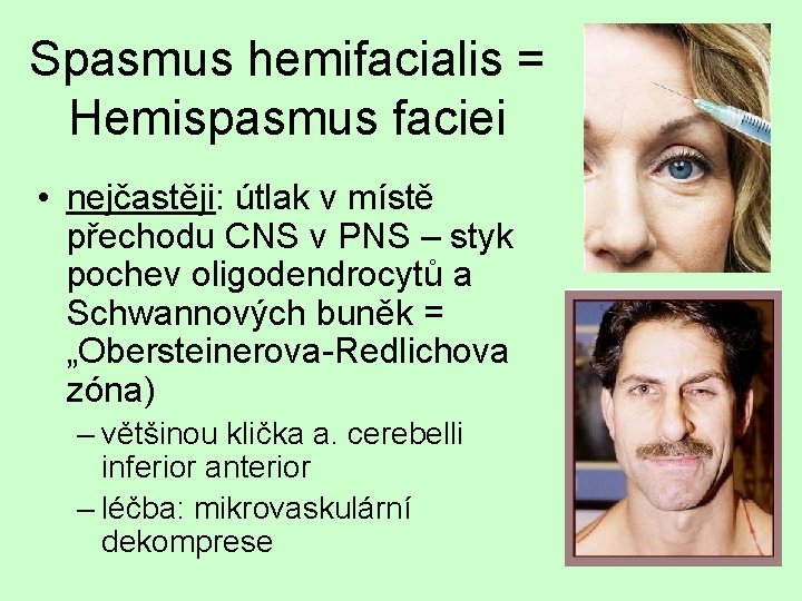 Spasmus hemifacialis = Hemispasmus faciei • nejčastěji: útlak v místě přechodu CNS v PNS