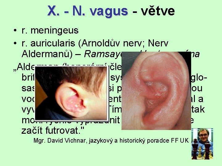 X. - N. vagus - větve • r. meningeus • r. auricularis (Arnoldův nerv;