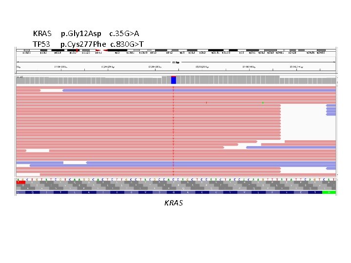 KRAS TP 53 p. Gly 12 Asp c. 35 G>A p. Cys 277 Phe