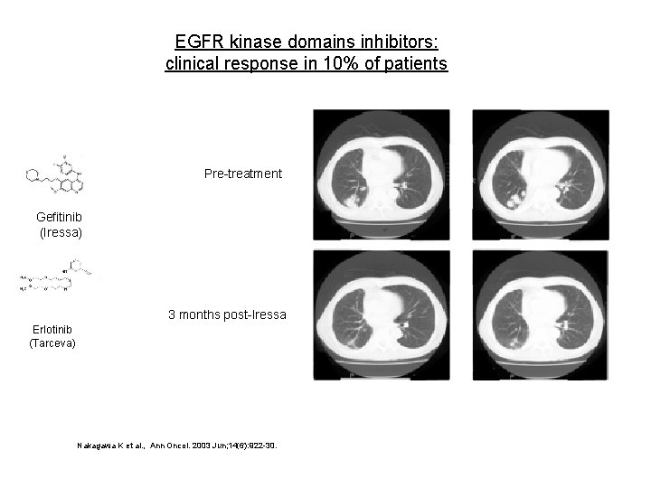 EGFR kinase domains inhibitors: clinical response in 10% of patients Pre-treatment Gefitinib (Iressa) 3