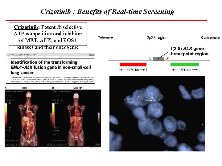 Crizotinib : Benefits of Real-time Screening Crizotinib: Potent & selective ATP competitive oral inhibitor