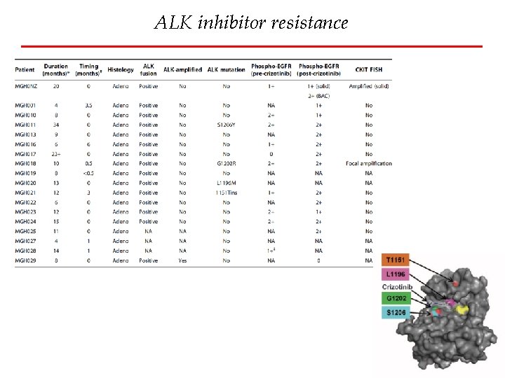 ALK inhibitor resistance 