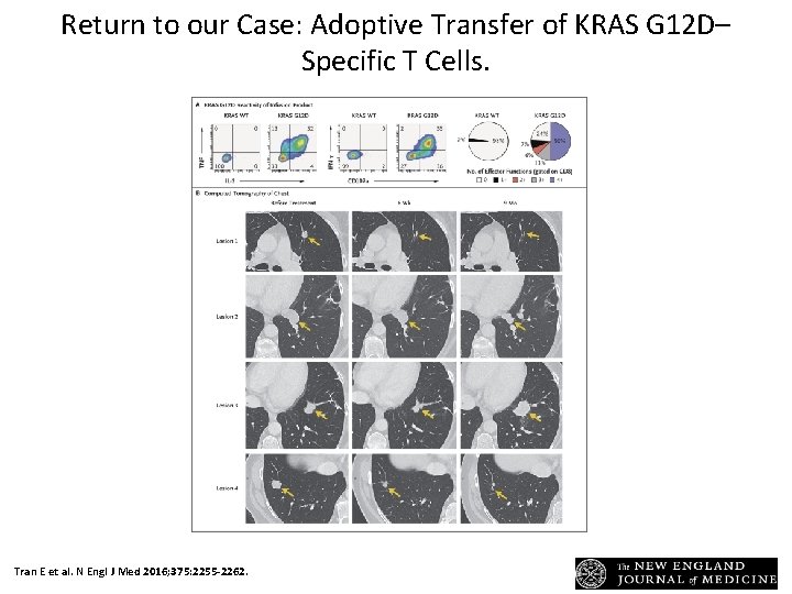 Return to our Case: Adoptive Transfer of KRAS G 12 D– Specific T Cells.