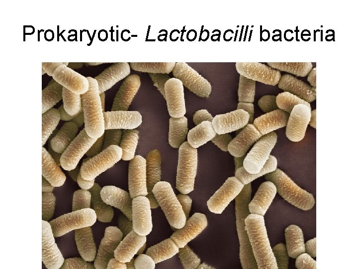 Prokaryotic- Lactobacilli bacteria 