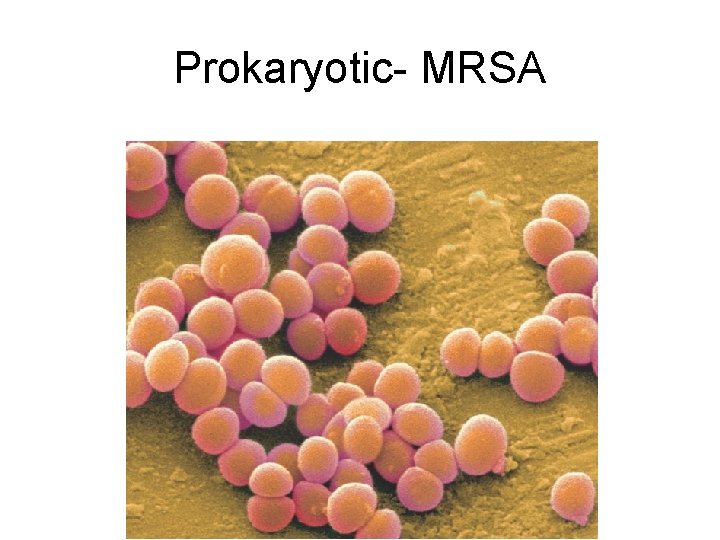 Prokaryotic- MRSA 