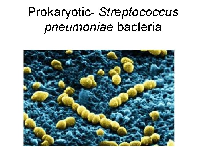 Prokaryotic- Streptococcus pneumoniae bacteria 