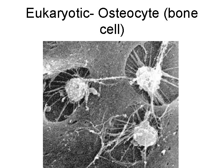 Eukaryotic- Osteocyte (bone cell) 