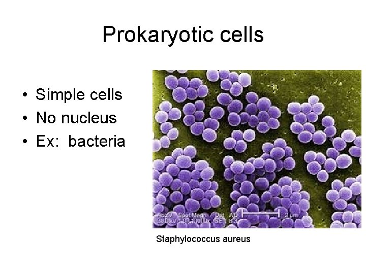 Prokaryotic cells • Simple cells • No nucleus • Ex: bacteria Staphylococcus aureus 