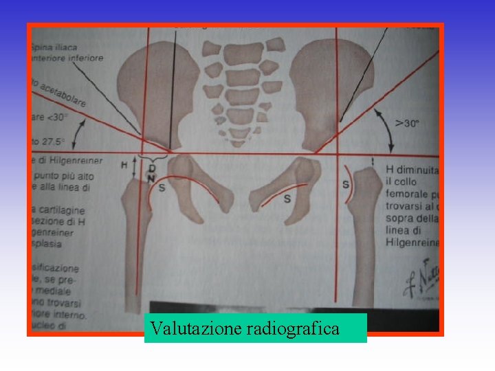 Valutazione radiografica 