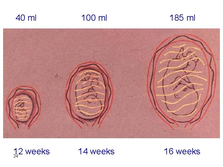 40 ml 12 weeks 24 100 ml 185 ml 14 weeks 16 weeks 