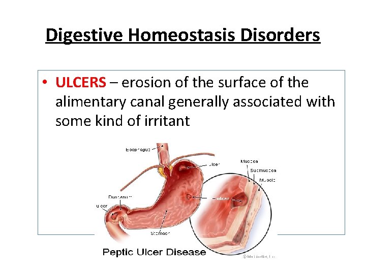 Digestive Homeostasis Disorders • ULCERS – erosion of the surface of the alimentary canal Digestive Homeostasis Disorders • ULCERS – erosion of the surface of the alimentary canal