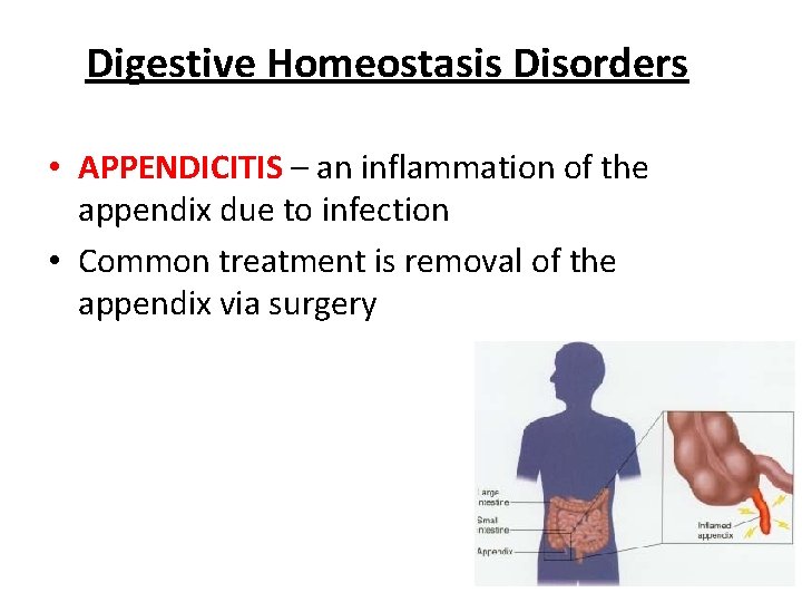 Digestive Homeostasis Disorders • APPENDICITIS – an inflammation of the appendix due to infection Digestive Homeostasis Disorders • APPENDICITIS – an inflammation of the appendix due to infection