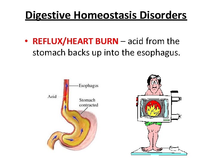 Digestive Homeostasis Disorders • REFLUX/HEART BURN – acid from the stomach backs up into Digestive Homeostasis Disorders • REFLUX/HEART BURN – acid from the stomach backs up into