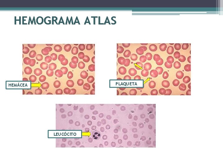 HEMOGRAMA ATLAS PLAQUETA HEMÁCEA LEUCÓCITO 