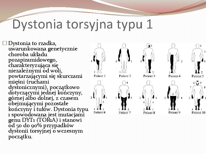 Dystonia torsyjna typu 1 � Dystonia to rzadka, uwarunkowana genetycznie choroba układu pozapiramidowego, charakteryzująca